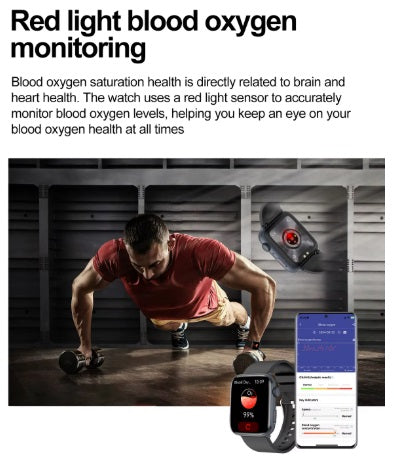 Xiaomi Series 10 Smartwatch - Gold Gehäuse, Gold Armband Stahl glatt