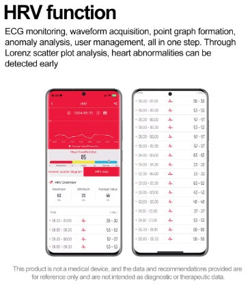 Xiaomi Series 10 Smartwatch - Gold Gehäuse, Gold Armband Stahl glatt