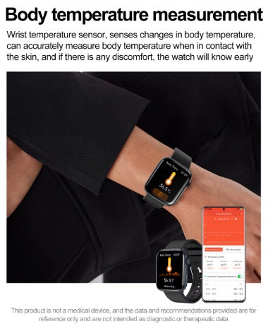 Xiaomi Series 10 Smartwatch - Gold Gehäuse, Gold Armband Stahl glatt